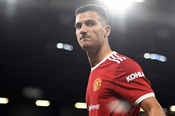 ดีโอโก้ ดาโลต์